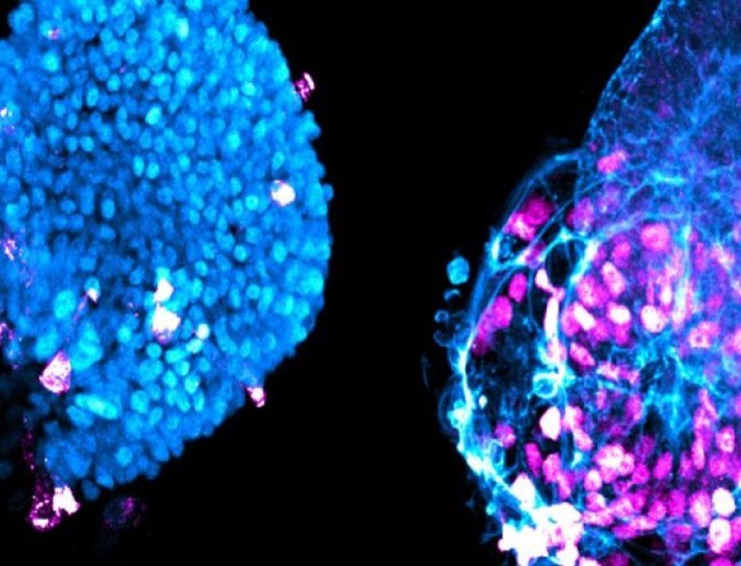 Unos "minipulmones" de laboratorio podrían ser la clave del abordaje de enfermedades respiratorias